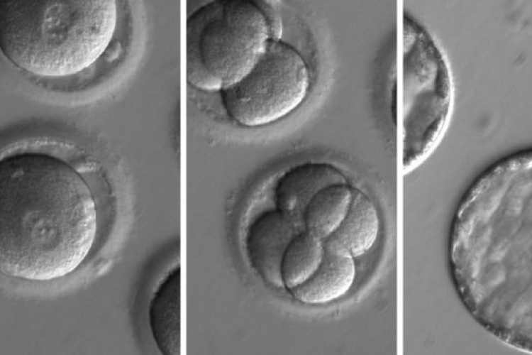 Először iktattak ki betegséget okozó DNS-t humán embrióból